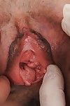 Skinny granny Rozi has her pussy stretched for vulva and clitoris exposure